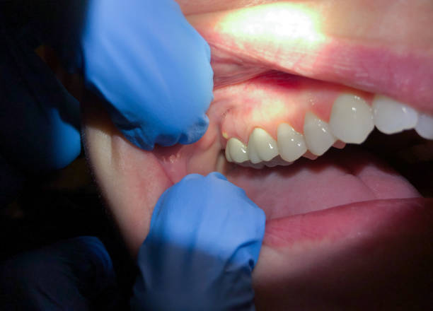 Best Emergency Root Canal Treatment in Peachtree Corners, GA
